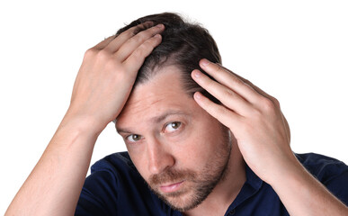 Fototapeta premium Dandruff problem. Man examining his head on white background
