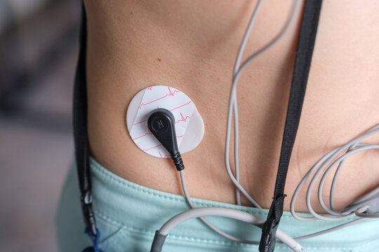 Holter monitor electrode placed on the skin of a person's back, connected by wires to a device for continuous heart activity monitoring