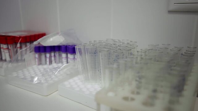 Medical collection tubes stand organized in plastic holding racks. Orderly preparation suggests readiness for blood diagnostic tests