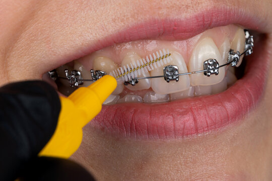  Dental hygiene concept