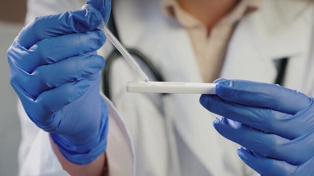 Medical professional in blue gloves applying liquid sample to rapid diagnostic test strip with pipette in laboratory.