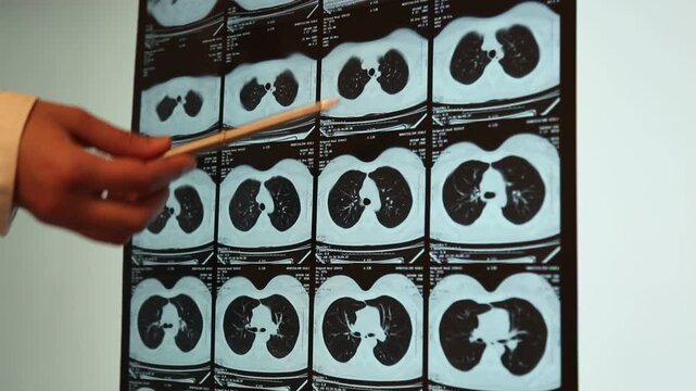 Radiologist Examining Chest CT Scans