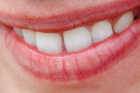 Close-up of a bright, healthy smile with perfect white teeth