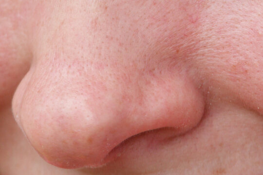 Close-up of human nose skin, showing pores and soft texture