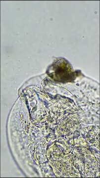 Bacteria Feeding on Dead Rotifers Under Microscope