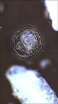 Resting Egg of Rotifer Under Darkfield Microscope