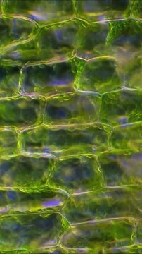 Microscope View of Plant Leaf Cells with Chloroplasts