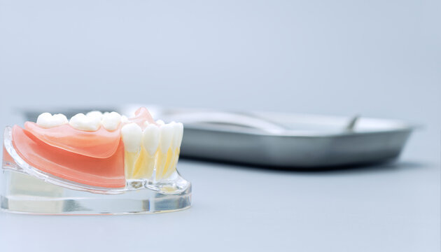 Anatomical Lower Jaw Dental Model with Removable Gum and Blurred Medical Tray on Light Background