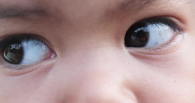 Macro close-up of a young child eye showing natural details, representing vision, eye health, child development, innocence, curiosity, pediatric care, and healthy growth, Asian child