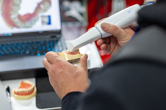 Digital Dental Scanner Demonstration on a Teeth Model. Person using a handheld intraoral scanner on a dental model beside a laptop displaying a digital image of teeth.