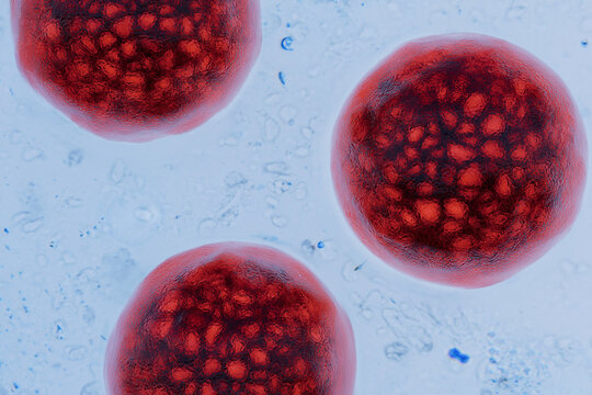 High magnification microscopic view of Cyclospora cayetanensis oocysts stained red. Conceptual for Cyclosporiasis outbreak, foodborne parasite illness, medical microbiology research. water pollution