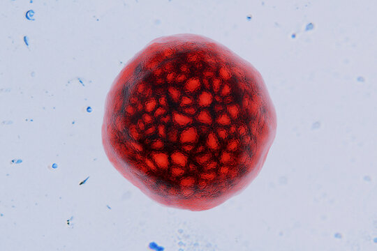 Extreme microscopic close-up of a single Cyclospora cayetanensis oocyst stained red. Ideal for medical concepts regarding cyclosporiasis outbreak, parasite infection, and microbiology.