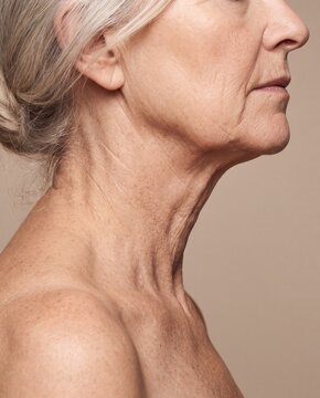 Mature woman profile showing sagging jawline and neck wrinkles