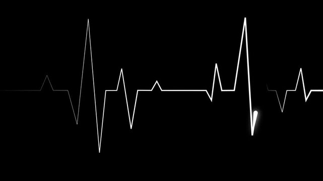 Heartbeat line electrocardiogram style pulse graph with sharp spikes and a minimal medical theme animation