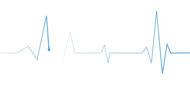 Heartbeat lines electrocardiogram style pulse with sharp spikes and flat sections animation