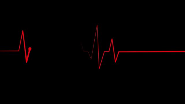 Heartbeat line pulse spike and flat line medical concept for heart health monitoring and emergency care animation