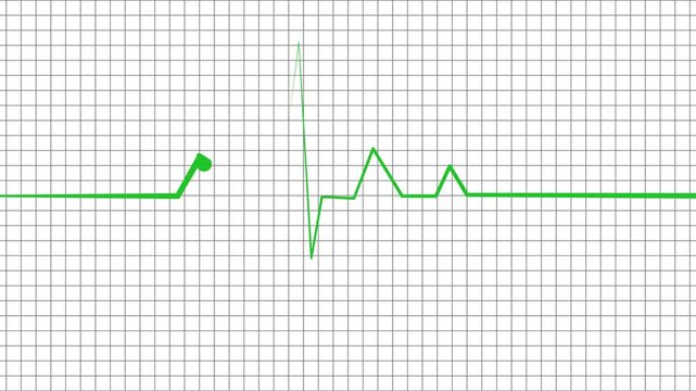 Heartbeat line with a single sharp spike and flat line showing a medical monitor pulse wave signal animation