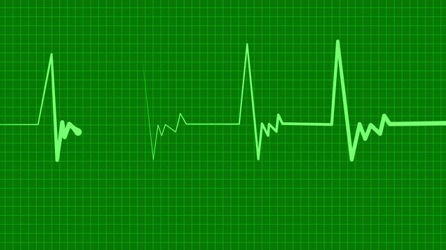 Heart monitor line medical pulse pattern with a flat section and sharp spikes animation