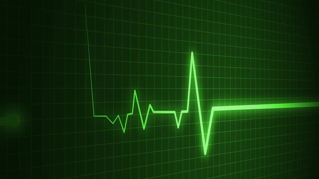 Heart beat line on graph paper showing an ecg pattern and medical signal animation