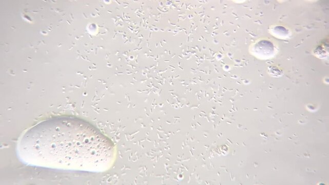 Microscopic view of moving bacteria rod-shaped bacilli and lipid droplets in contaminated food sample