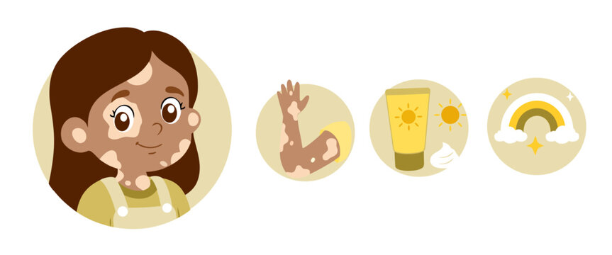 Cute little girl with vitiligo skin condition skincare icons set vector illustration

