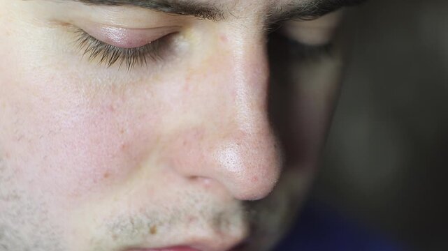 Detailed Macro of Lower Eyelid Stye