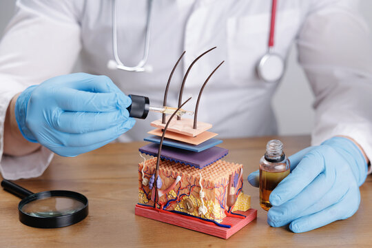 Medical trichologist professional applying topical oil serum with dropper to layered skin and hair model for dermatology