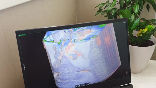 Interactive 3D Medical Scan Manipulation of Human Skull with Cursor. Dental