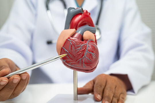 Cardiovascular disease CVD, doctor with heart human model.