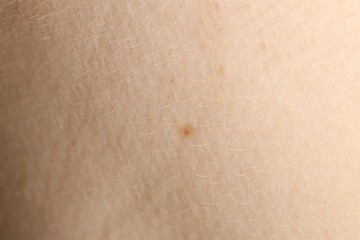 Fototapeta premium Texture of normal skin as background, closeup
