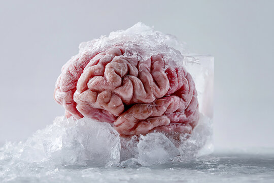 A human brain model sits on a neutral surface partially encased in ice. Medical and neuroscience themes: cryonics, frozen mind, memory preservation, cold cognition, research and anatomy.