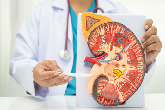 Chronic kidney disease, doctor with model for treatment urinary system, urology, Estimated glomerular filtration rate eGFR.