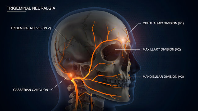 Medical illustration of the trigeminal nerve and skull anatomy