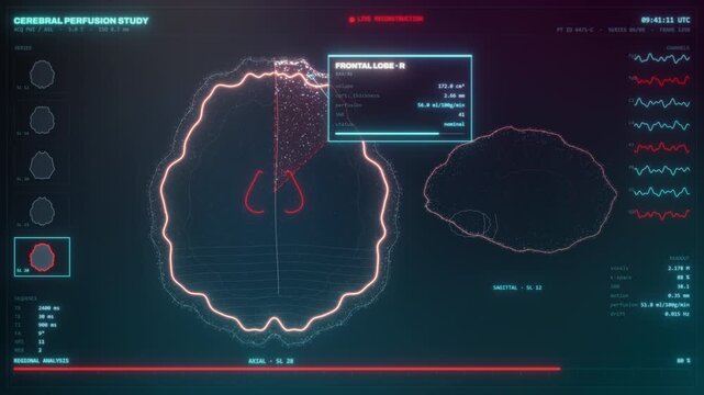 Live cerebral perfusion analysis compares axial and sagittal brain views on a glowing medical screen, built for clinical education and healthcare advertising