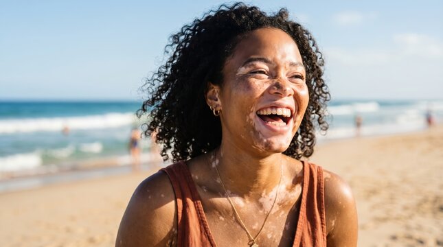 Happy young woman with curly hair and vitiligo laughing on sandy beach. Portrait of female model enjoying sunny day at seaside. Concept of self acceptance, body positivity and lifestyle.