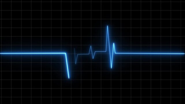 Digital electrocardiogram waveform pulsing blue light against black background with grid
