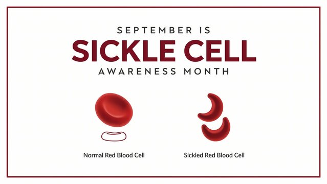 Sickle Cell Awareness Month Graphic with Normal and Sickled Red Blood Cells