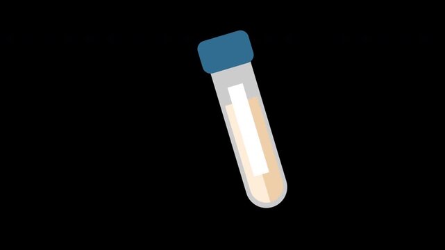 medical test tube with blue cap containg sample for analysis