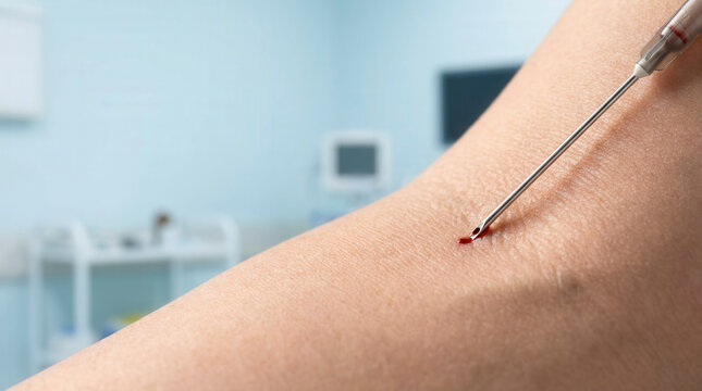 Phlebotomy needle insertion into arm for diagnostic blood test, healthcare and medical procedure