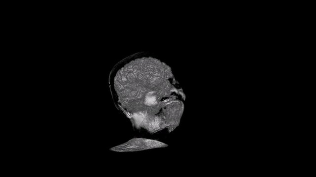 3D Rotating Brain MRI Volume Reconstruction Revealing Detailed Cortical Surface Architecture and Skull Outline