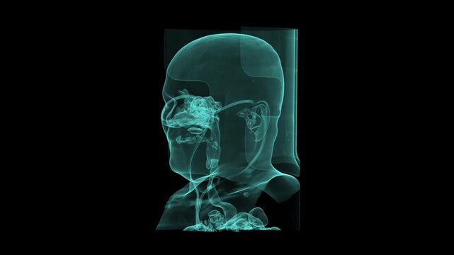 3D Cyan Volumetric CT Scan Render of Human Head Profile Showing Skull Base Facial Bones and Nasal Cavity
