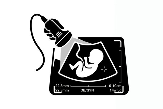 Medical ultrasound icon, fetal sonogram on screen with scanner probe, prenatal pregnancy vector