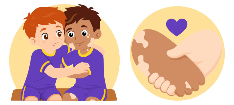 Boy with vitiligo hugging his friend. Friendship and inclusion cartoon vector illustration