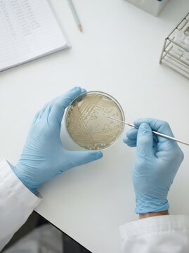 Scientist in blue gloves examining bacterial colonies in a petri dish in a microbiology laboratory for research