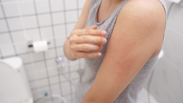 skin problem and beauty. Young woman scratch body has itchy skin from skin allergic, steroid allergy, sensitive skin, red from sunburn, chemical allergy, rash, insect bites, Seborrheic Dermatitis.