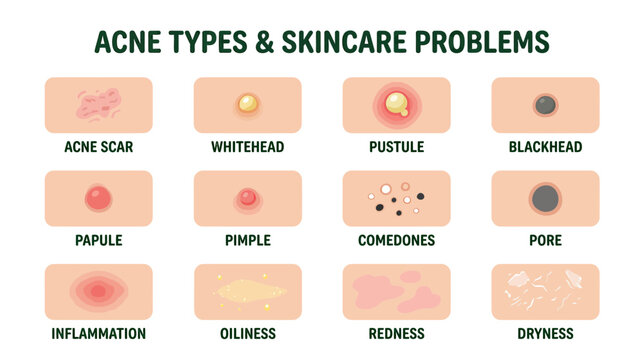 Skin Conditions and Skincare Problems Illustration