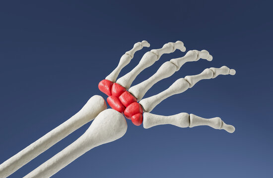Human wrist skeleton with highlighted red carpal bones, realistic 3D Rendering style, isolated on blue background, illustrating anatomy, injury, and pain