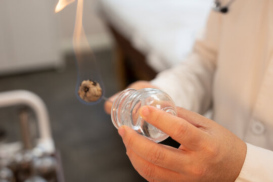 Close-up of a practitioner holding a clear glass jar and a burning cotton swab