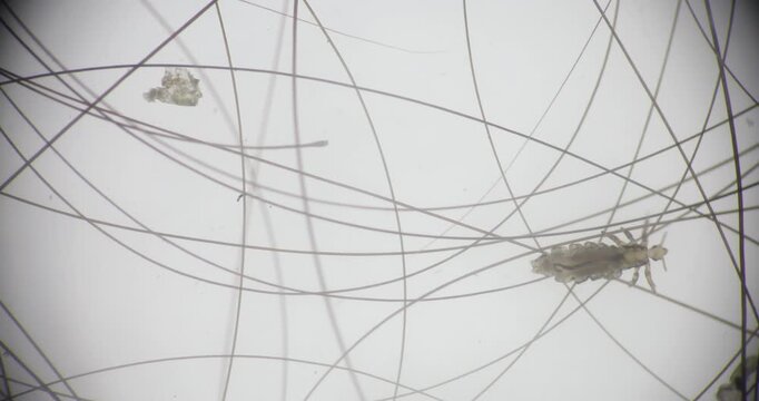 Human Head Louse and Nits (Pediculus humanus capitis) Attached to Human Hair Under Microscope | Microscopic Close-Up of Lice Infestation.