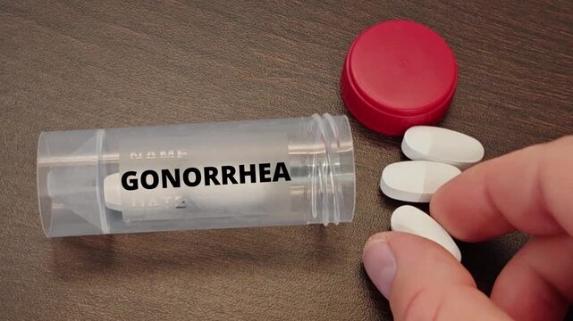 GONORRHEA infectious disease topic for diagnosis, treatment and prevention tablet taken by a patient